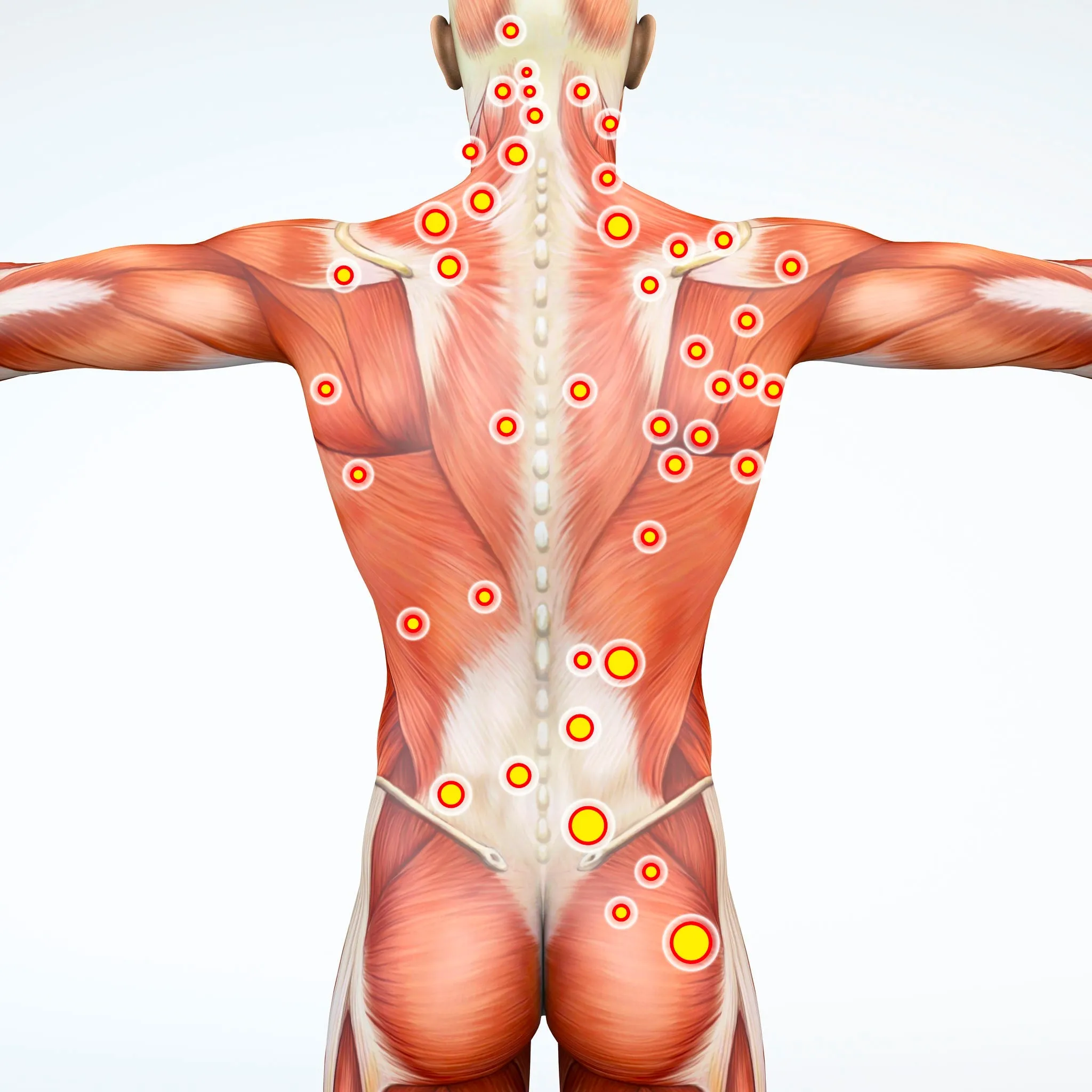 12 CE Hour Myofascial & Neuromuscular Therapy (Computer-Based Live Interactive Webinar)